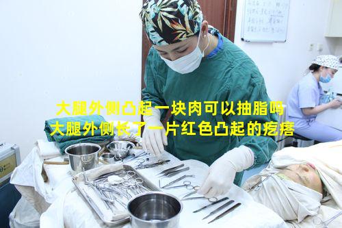 大腿外侧凸起一块肉可以抽脂吗 大腿外侧长了一片红色凸起的疙瘩